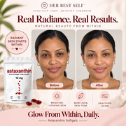 Astaxanthin Softgels